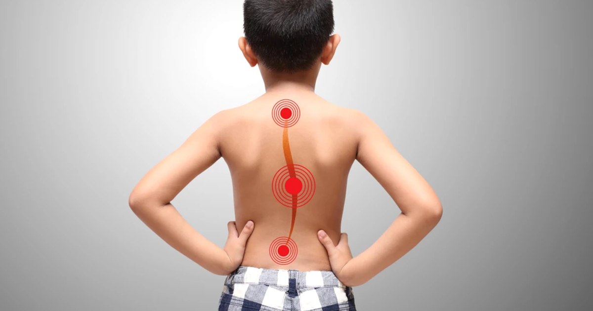 Sistemul medical e defect: sute de copii din România așteaptă operații pentru scolioză